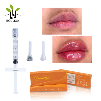 Cross linked 1 Ml Hyaluronic Acid Lips Injectable Long Lasting Dermal Filler