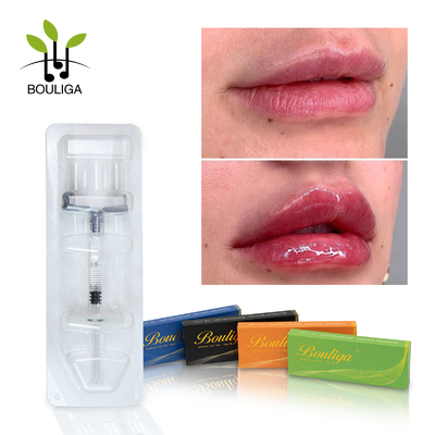 Ce Approved Injectable Hyaluronic Acid Dermal Filler Lip Enhancement