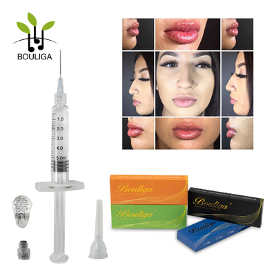 Face Care Dermal Filler Injectable Ha Buy Online Hyaluronic Acid for Lips