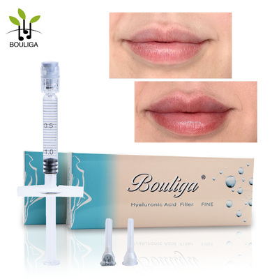 1ml Micro Droplets Lip Filler Injections Cross Linked Hyaluronic Acid