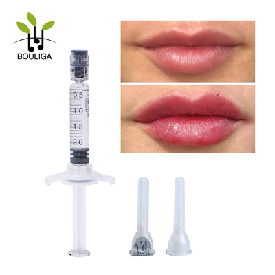 ha injections,hyaluronic acid dermal filler for lip enchance
