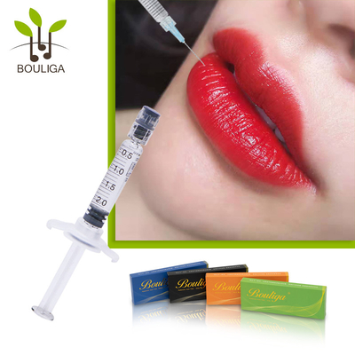 3ml Volume Crosslinked Hyaluronic Acid Cosmetic Injections For Lips