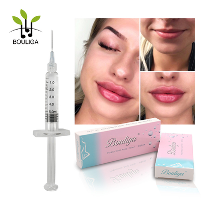 Gel 2ml Injectable Hyaluronic Acid Dermal Filler For Gorgeous Results Lips