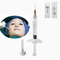 Korean Lip 1ml Hyaluronic Acid Dermal Filler For Marionette Lines